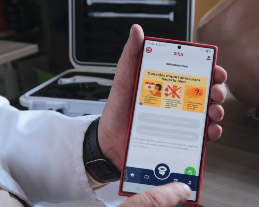 SISA: inteligencia artificial y automuestreo para mejorar la detección temprana del VPH
